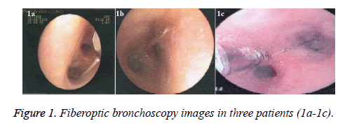 biomedres-risk-Fiberoptic-bronchoscopy