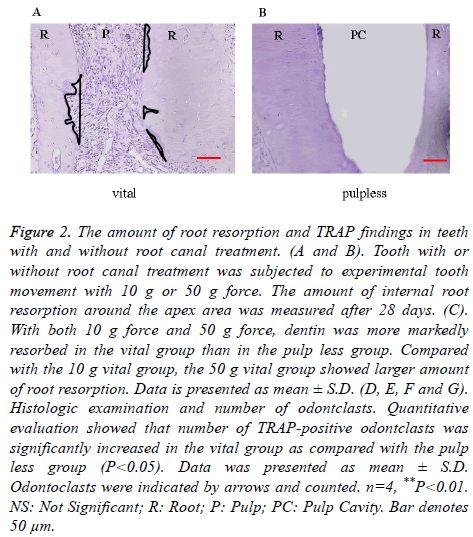 biomedres-root-resorption