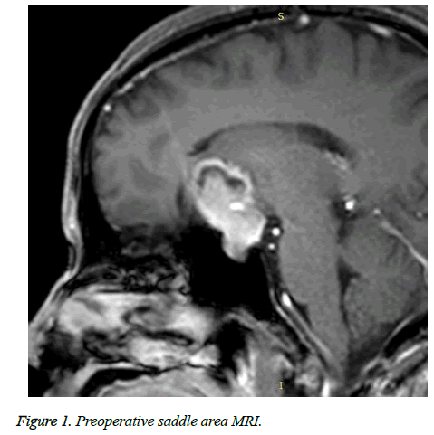 biomedres-saddle-area