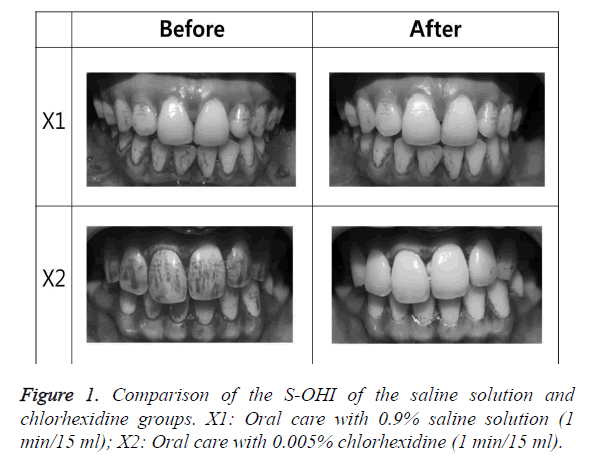 biomedres-saline-solution