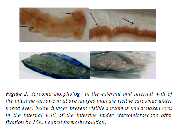 biomedres-sarcoma-morphology