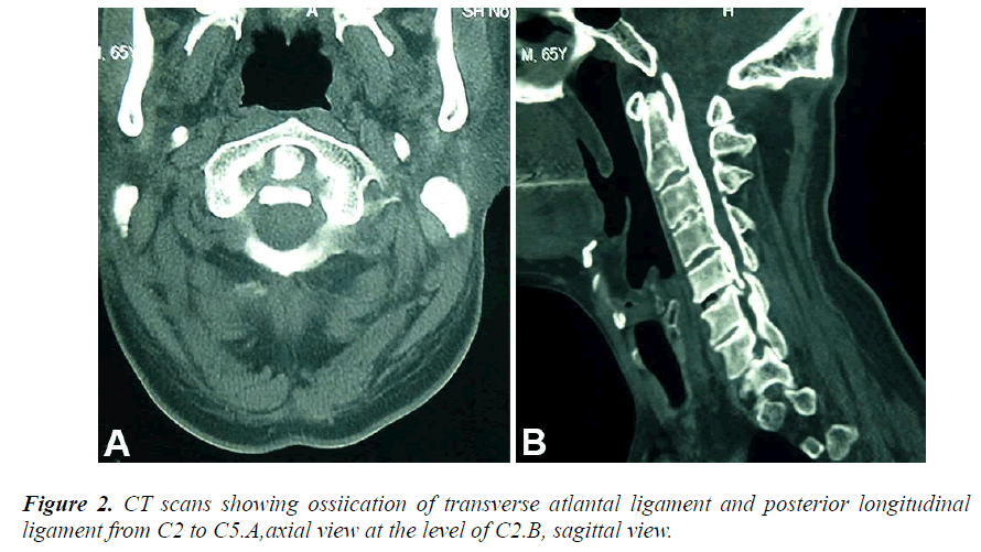 biomedres-scans-showing-ossiication