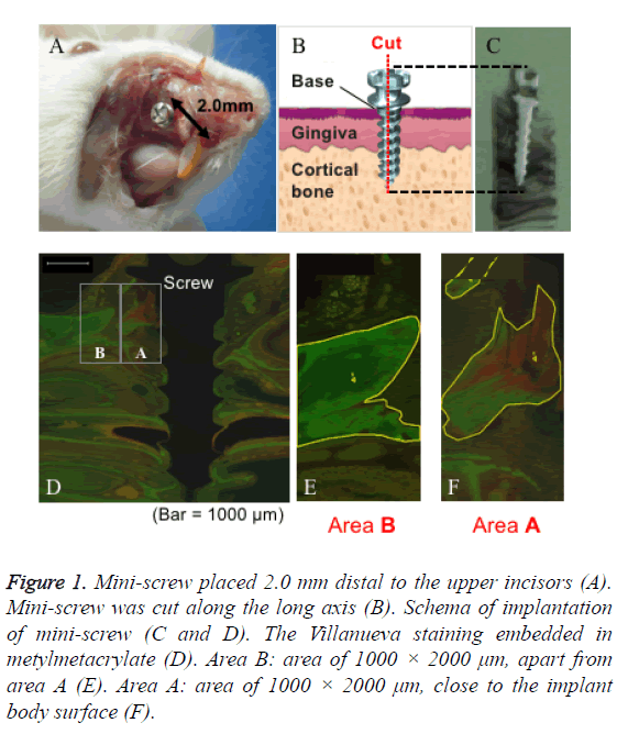 biomedres-schema-implantation