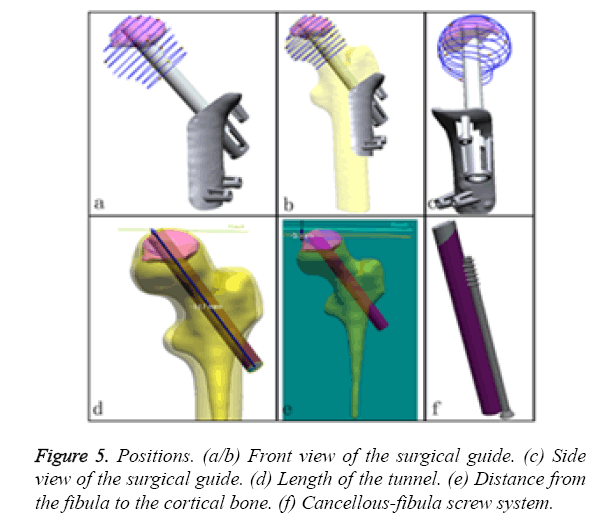 biomedres-screw-system