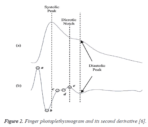 biomedres-second-derivative