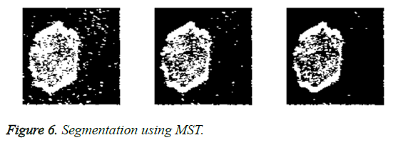 biomedres-segmentation-MST