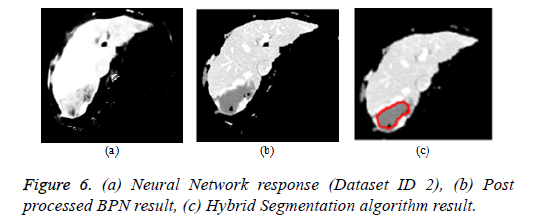 biomedres-segmentation-algorithms