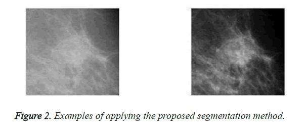 biomedres-segmentation-method