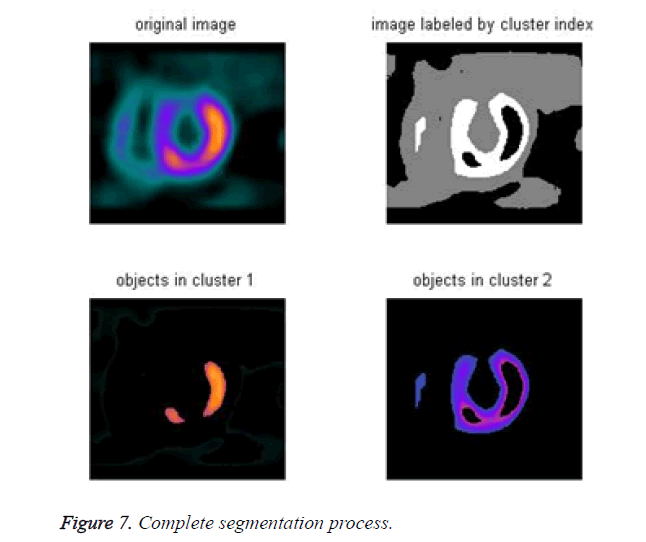 biomedres-segmentation-process