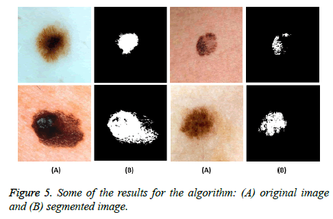 biomedres-segmented-image