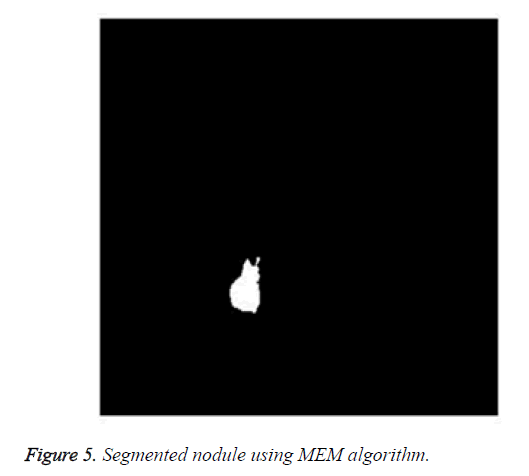 biomedres-segmented-nodule