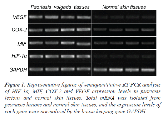 biomedres-semiquantitative-RT-PCR