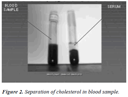 biomedres-separation-of-cholesterol