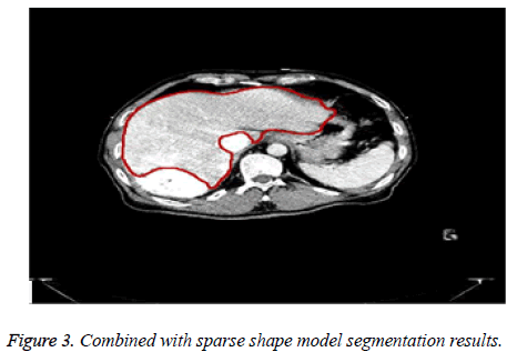 biomedres-shape-model