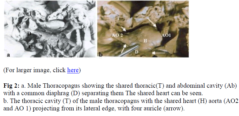 biomedres-shared-thoracic