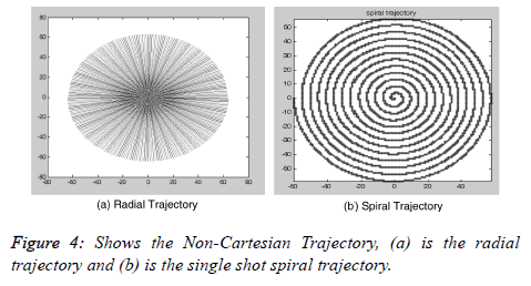 biomedres-shot-spiral-trajectory