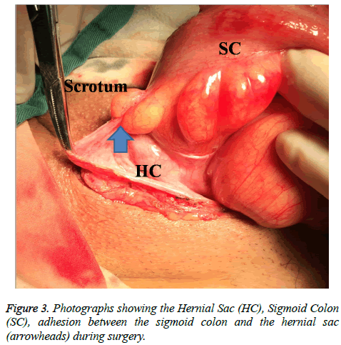 biomedres-sigmoid-colon