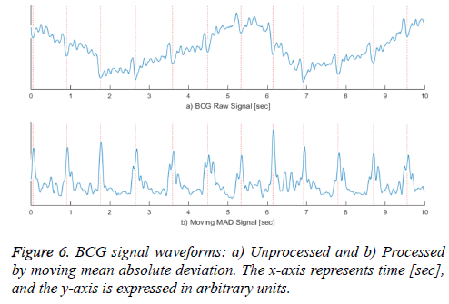 biomedres-signal-waveforms