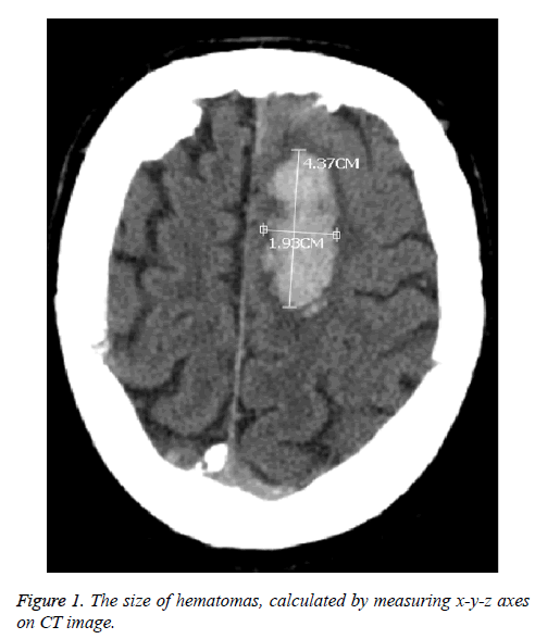 biomedres-size-hematomas