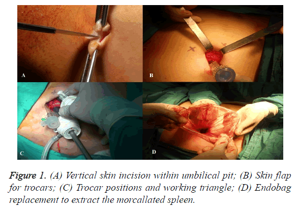 biomedres-skin-incision