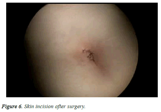 biomedres-skin-incision-surgery