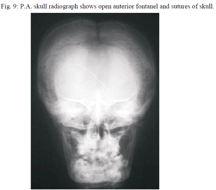 biomedres-skull-radiograph