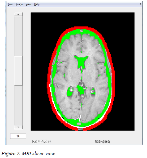 biomedres-slicer-view