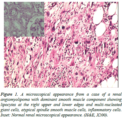 biomedres-smooth-muscle