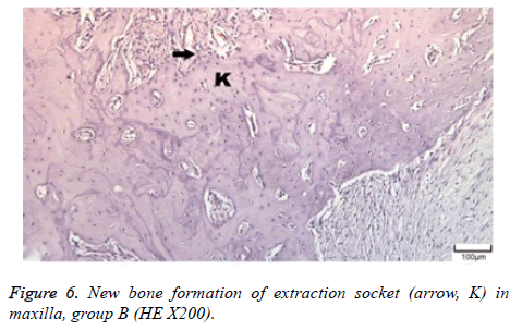 biomedres-socket-maxilla