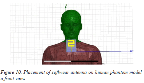 biomedres-softwear-antenna