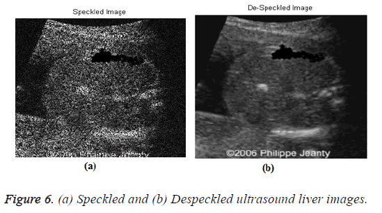biomedres-speckled-despeckled-ultrasound