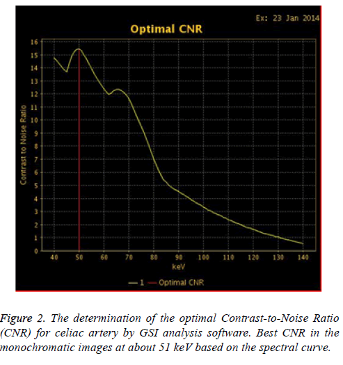 biomedres-spectral-curve