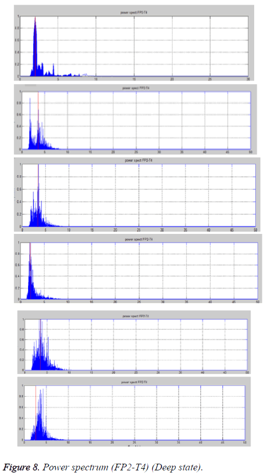 biomedres-spectrum-Deep-state