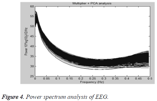 biomedres-spectrum-analysis-EEG