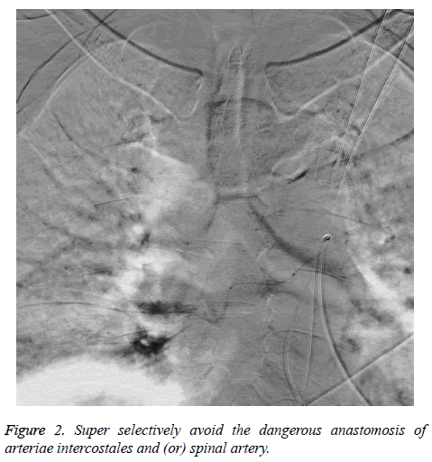 biomedres-spinal-artery