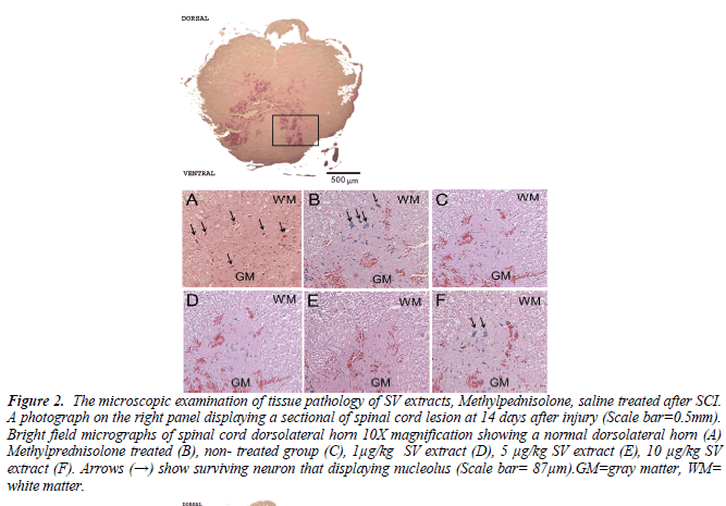 biomedres-spinal-cord-lesion