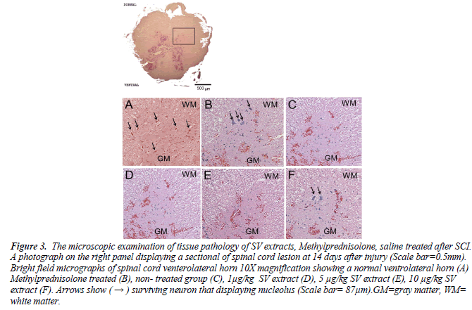 biomedres-spinal-cord-lesion