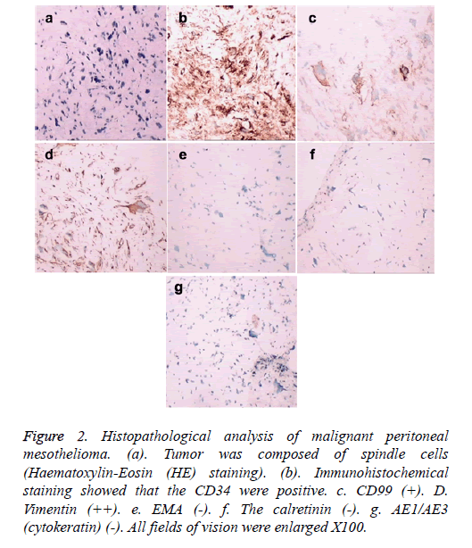 biomedres-spindle-cells-density