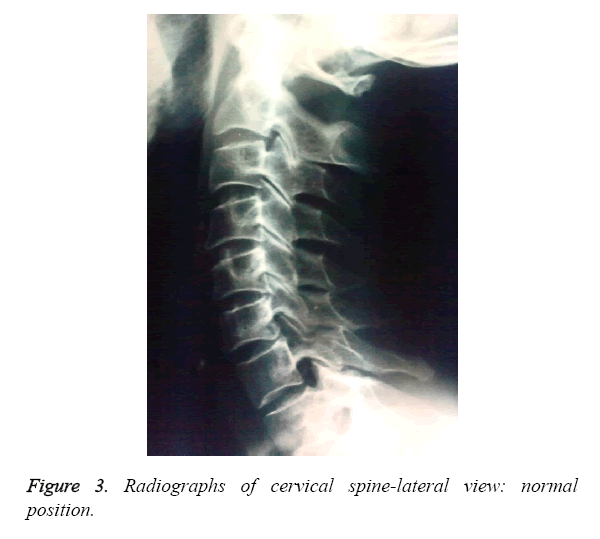 biomedres-spine-lateral
