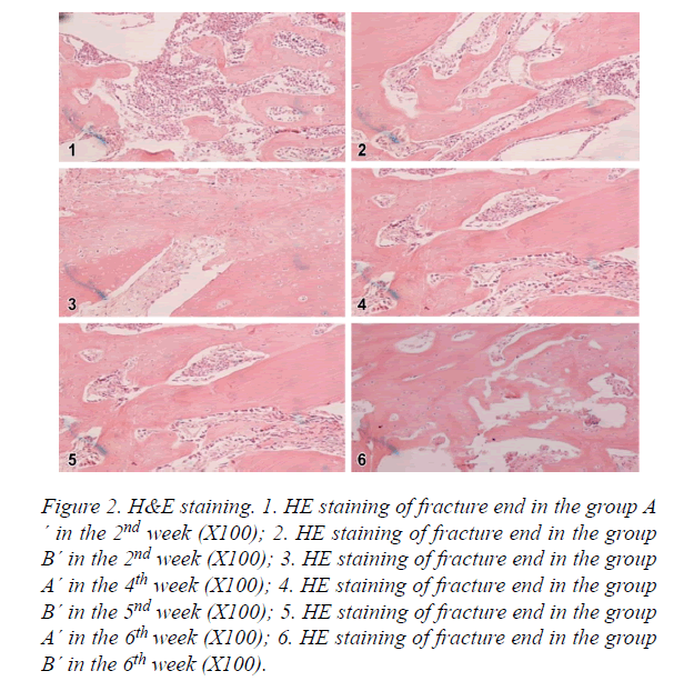 biomedres-staining-fracture