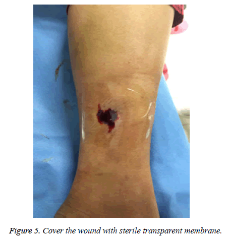 biomedres-sterile-transparent