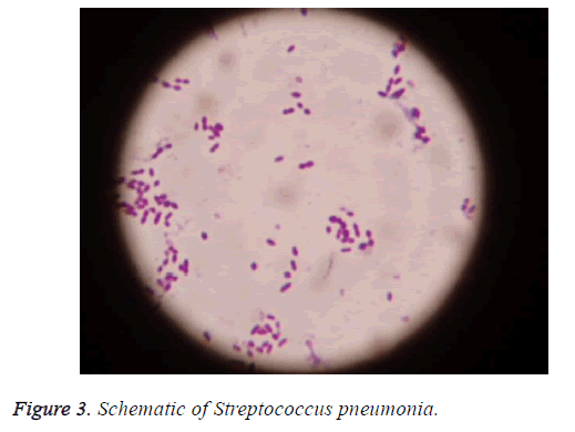 biomedres-streptococcus-pneumonia
