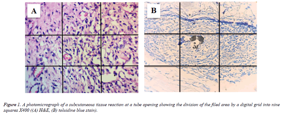 biomedres-subcutaneous-tissue