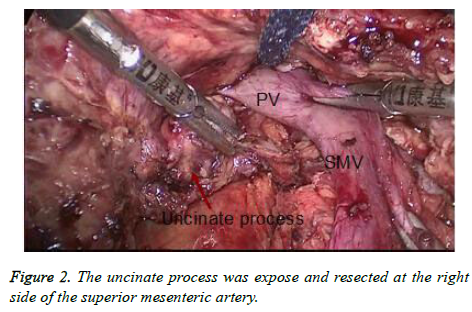 biomedres-superior-mesenteric-artery