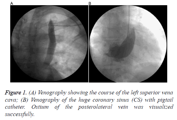 biomedres-superior-vena