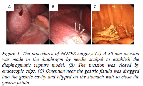 biomedres-surgery-needle