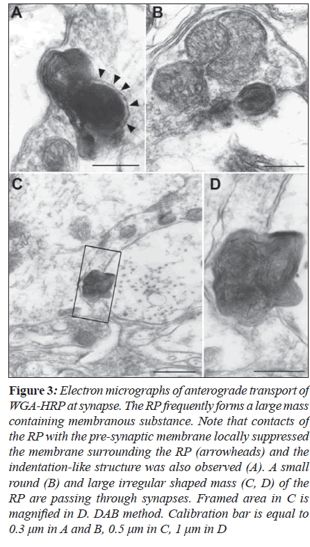 biomedres-synapse-forms-large-mass