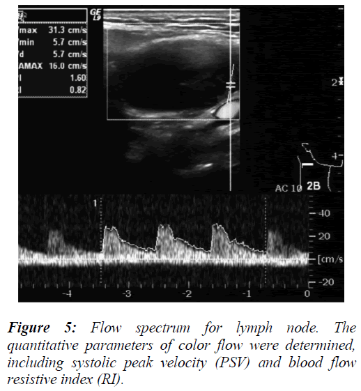 biomedres-systolic-peak-velocity