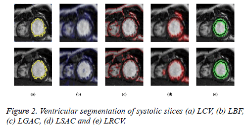 biomedres-systolic-slices