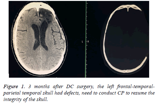 biomedres-temporal-skull